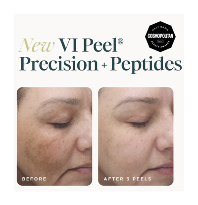VI Peel® - Precision + Peptides 