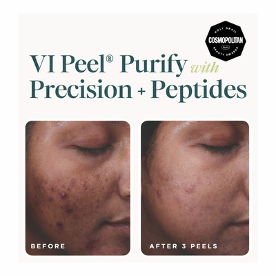 VI Peel® - Purify with Precision + Peptides